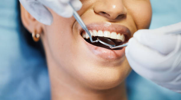 Best Emergency Broken Tooth Repair in Goshen, KY