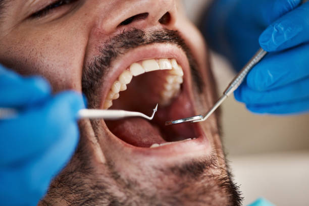 Professional Emergency Dentist in KY